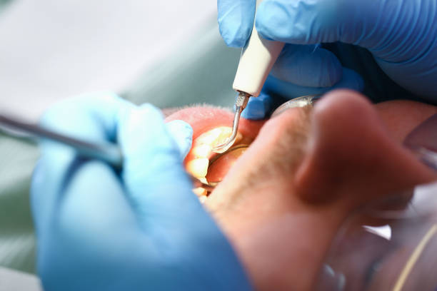 Best Emergency Care for Gum Disease in Bridgeport, IL